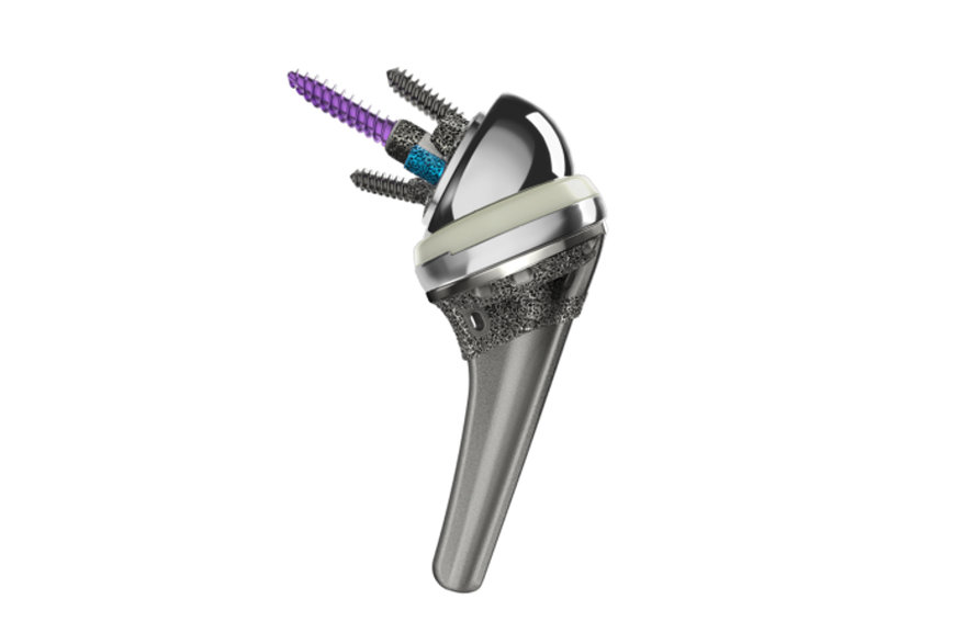 INHANCE™ SHOULDER SYSTEM: A NEW OPTION FOR REVERSE SHOULDER REPLACEMENT SURGERY